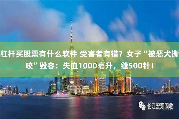 杠杆买股票有什么软件 受害者有错？女子“被恶犬撕咬”毁容：失血1000毫升，缝500针！